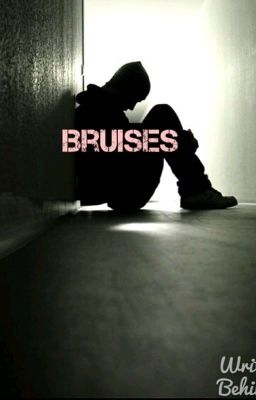 Bruises #Mashley(completed)