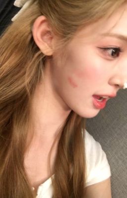 Hanaz | kiss