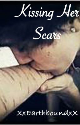 Kissing Her Scars
