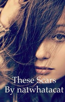 These Scars